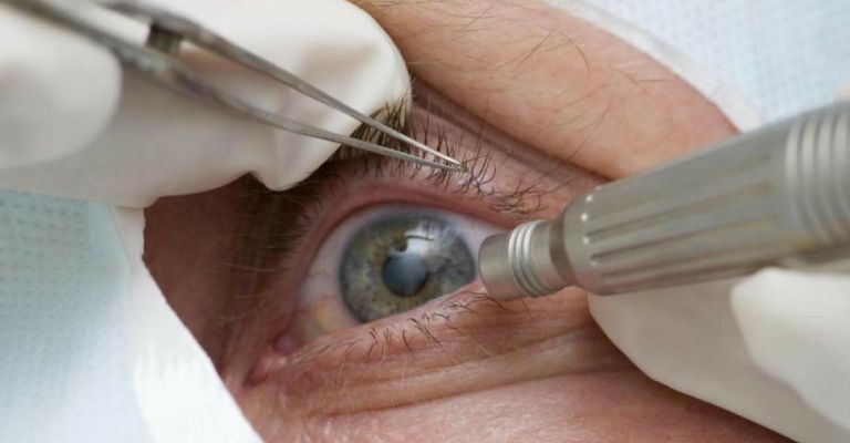 Exames para detecção precoce de glaucoma caem 30% durante a pandemia