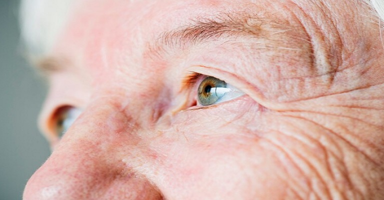 Glaucoma atinge milhões de pessoas no país e pode causar a perda de visão